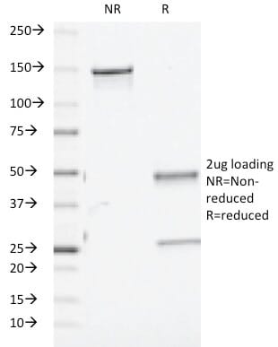 Anti-TGF beta Antibody [TGFB/510] (A250120) | Antibodies.com