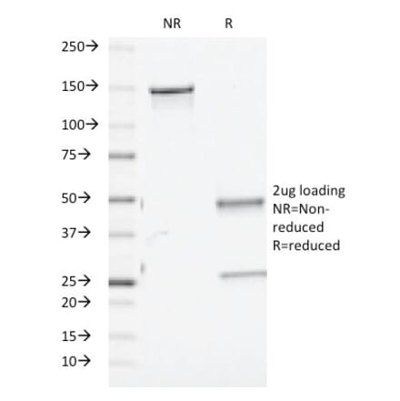 SDS-PAGE - Anti-TGF beta Antibody [TGFB/510] (A250119) - Antibodies.com