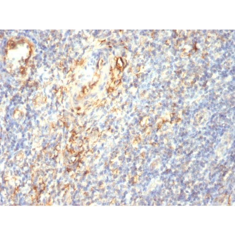 Immunohistochemistry - Anti-Transglutaminase II Antibody [SPM358] (A250122) - Antibodies.com