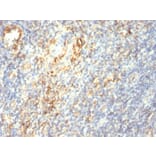 Immunohistochemistry - Anti-Transglutaminase II Antibody [SPM358] (A250122) - Antibodies.com