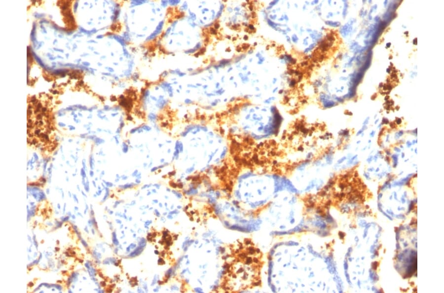 Immunohistochemistry - Anti-Transglutaminase II Antibody [SPM358] (A250122) - Antibodies.com