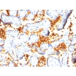 Immunohistochemistry - Anti-Transglutaminase II Antibody [SPM358] (A250122) - Antibodies.com