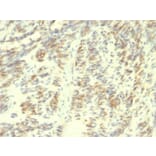 Immunohistochemistry - Anti-Transglutaminase II Antibody [SPM358] (A250120) - Antibodies.com
