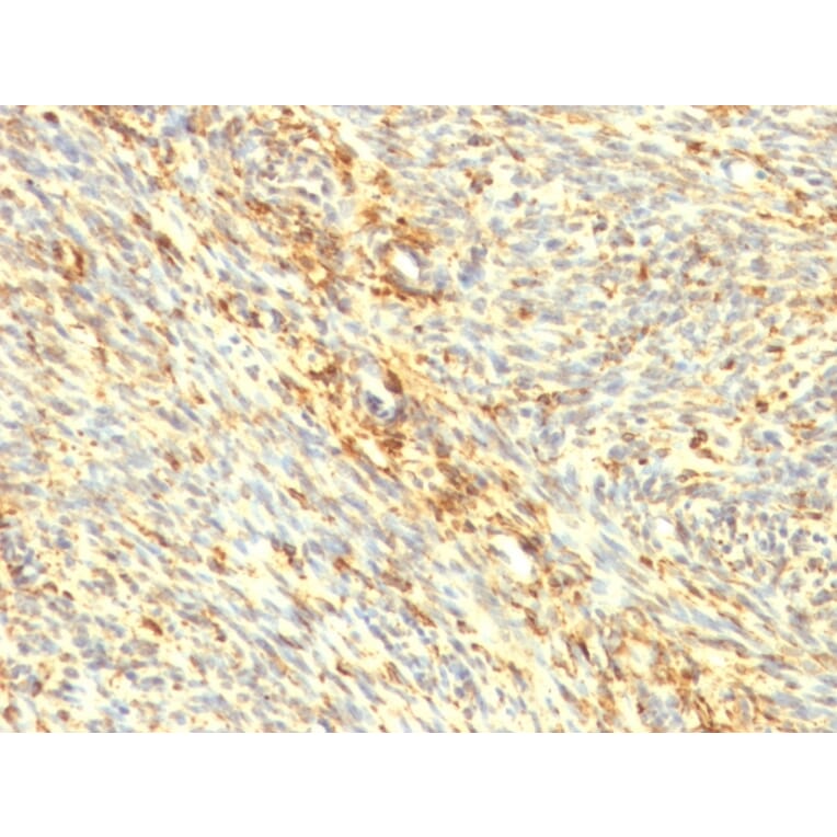 Immunohistochemistry - Anti-Transglutaminase II Antibody [SPM358] (A250122) - Antibodies.com