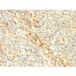 Immunohistochemistry - Anti-Transglutaminase II Antibody [SPM358] (A250122) - Antibodies.com