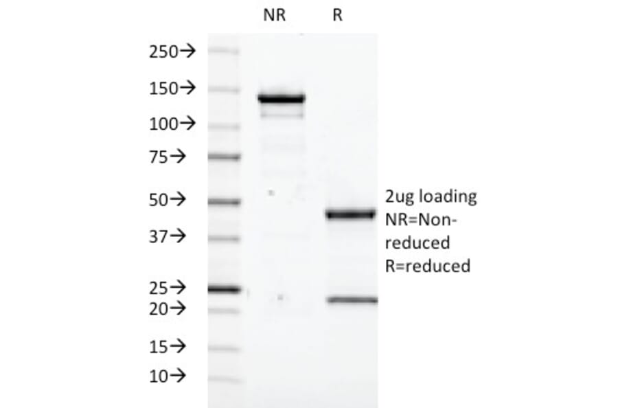 SDS-PAGE - Anti-Transglutaminase II Antibody [SPM358] (A250122) - Antibodies.com