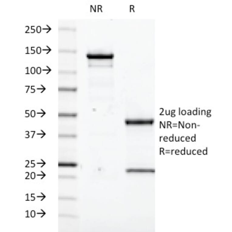 SDS-PAGE - Anti-Transglutaminase II Antibody [SPM358] (A250122) - Antibodies.com