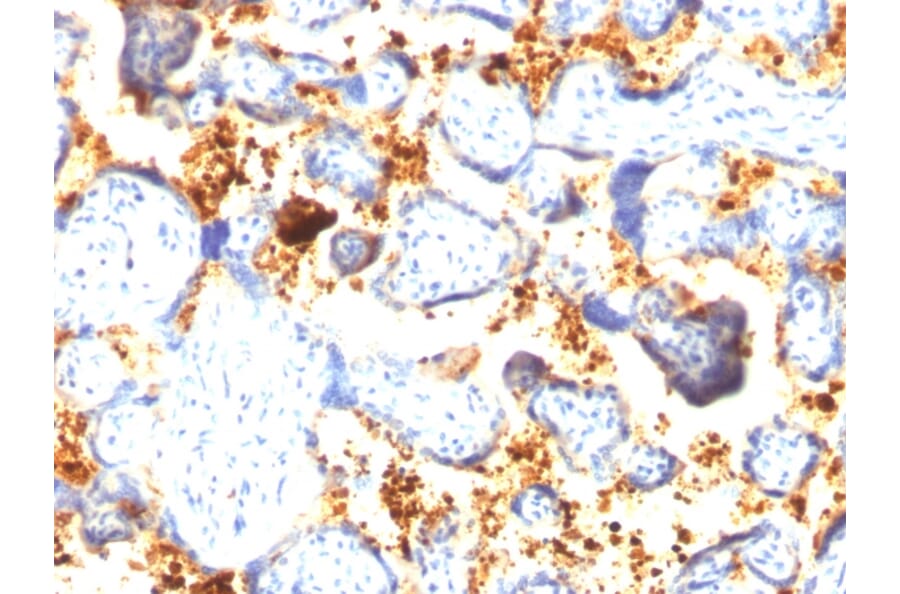 Immunohistochemistry - Anti-Transglutaminase II Antibody [SPM592] (A250122) - Antibodies.com