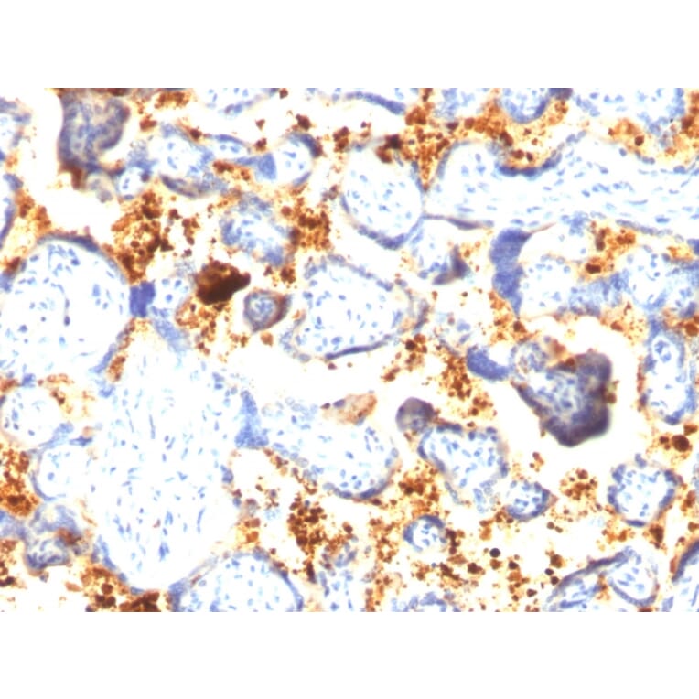 Immunohistochemistry - Anti-Transglutaminase II Antibody [SPM592] (A250122) - Antibodies.com