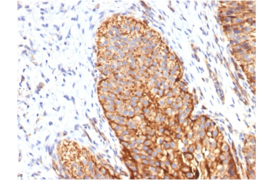 Immunohistochemistry - Anti-Thrombomodulin Antibody [THBD/1591] (A250124) - Antibodies.com