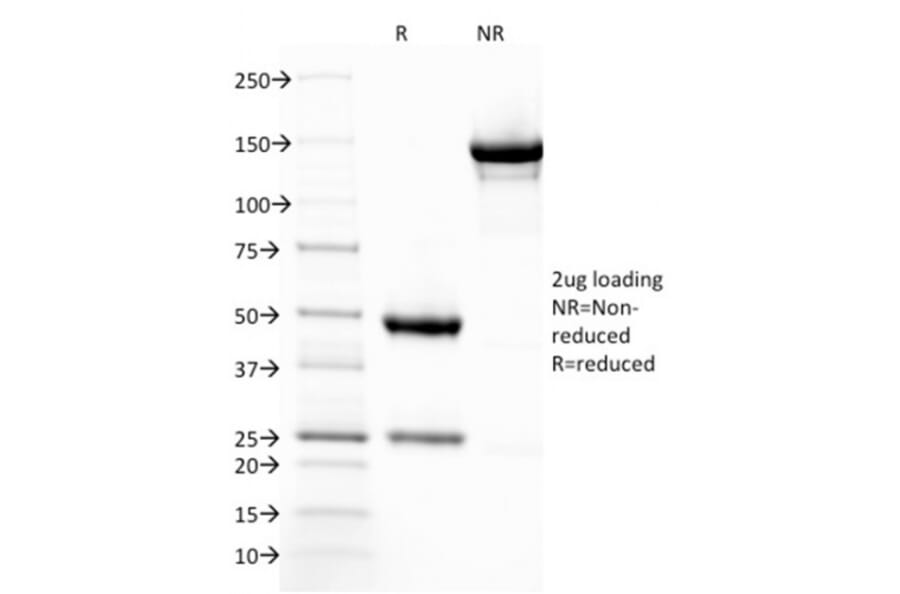SDS-PAGE - Anti-Thrombomodulin Antibody [THBD/1782] (A250125) - Antibodies.com