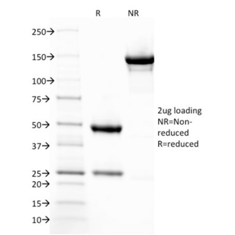 SDS-PAGE - Anti-Thrombomodulin Antibody [THBD/1782] (A250125) - Antibodies.com