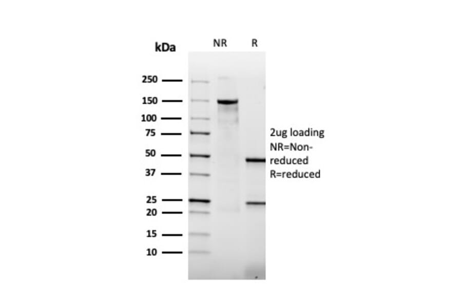 SDS-PAGE - Anti-Thrombomodulin Antibody [rTHBD/1591] (A250126) - Antibodies.com
