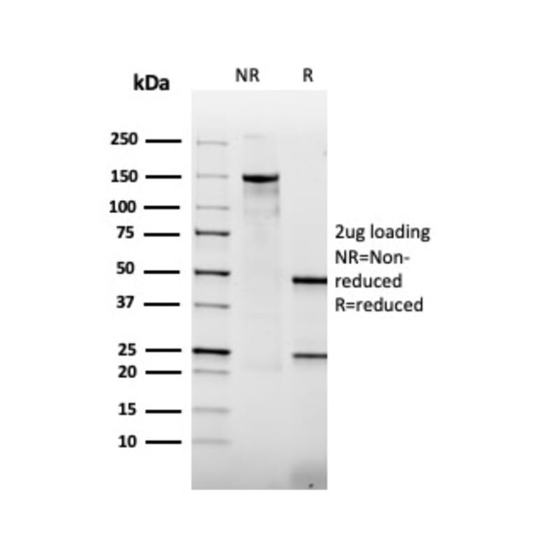 SDS-PAGE - Anti-Thrombomodulin Antibody [rTHBD/1591] (A250126) - Antibodies.com