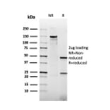 SDS-PAGE - Anti-Thrombomodulin Antibody [rTHBD/1591] (A250126) - Antibodies.com