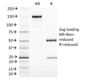 SDS-PAGE - Anti-TIA1 Antibody [TIA1/1313] (A250129) - Antibodies.com