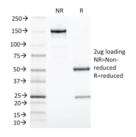 SDS-PAGE - Anti-TIA1 Antibody [TIA1/1313] (A250129) - Antibodies.com