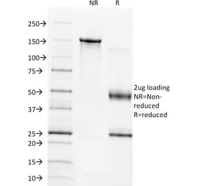 SDS-PAGE - Anti-TIMP1 Antibody [2A5] (A250129) - Antibodies.com