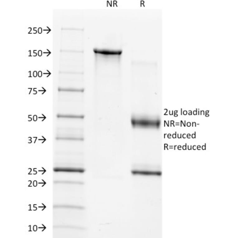 SDS-PAGE - Anti-TIMP1 Antibody [2A5] (A250129) - Antibodies.com