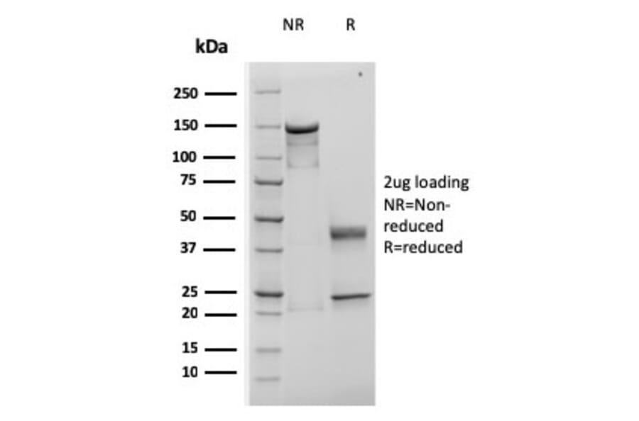 SDS-PAGE - Anti-TIMP1 Antibody [rTIMP1/1710] (A250130) - Antibodies.com