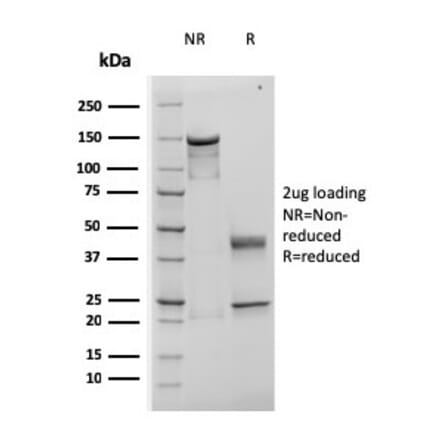 SDS-PAGE - Anti-TIMP1 Antibody [rTIMP1/1710] (A250130) - Antibodies.com