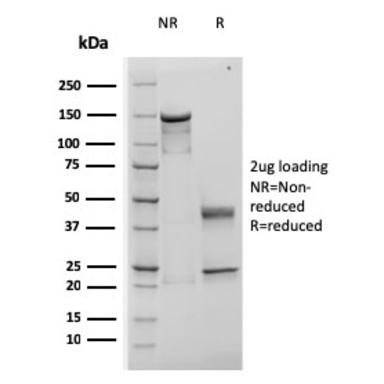 SDS-PAGE - Anti-TIMP1 Antibody [rTIMP1/1710] (A250130) - Antibodies.com