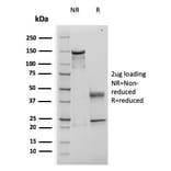 SDS-PAGE - Anti-TIMP1 Antibody [rTIMP1/1710] (A250130) - Antibodies.com