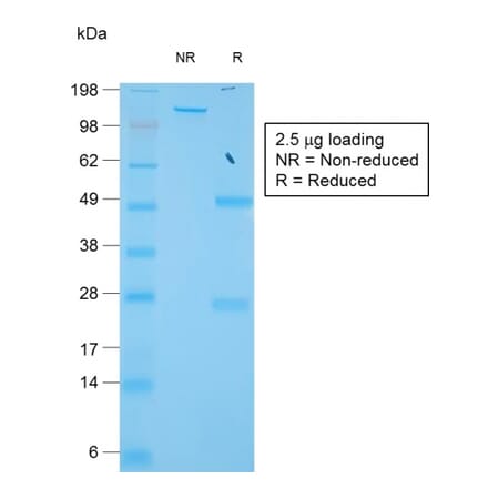 SDS-PAGE - Anti-TIMP1 Antibody [TIMP1/1944R] (A250131) - Antibodies.com
