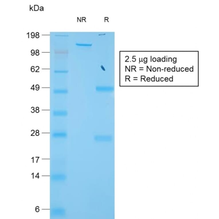 SDS-PAGE - Anti-TIMP1 Antibody [TIMP1/1944R] (A250131) - Antibodies.com