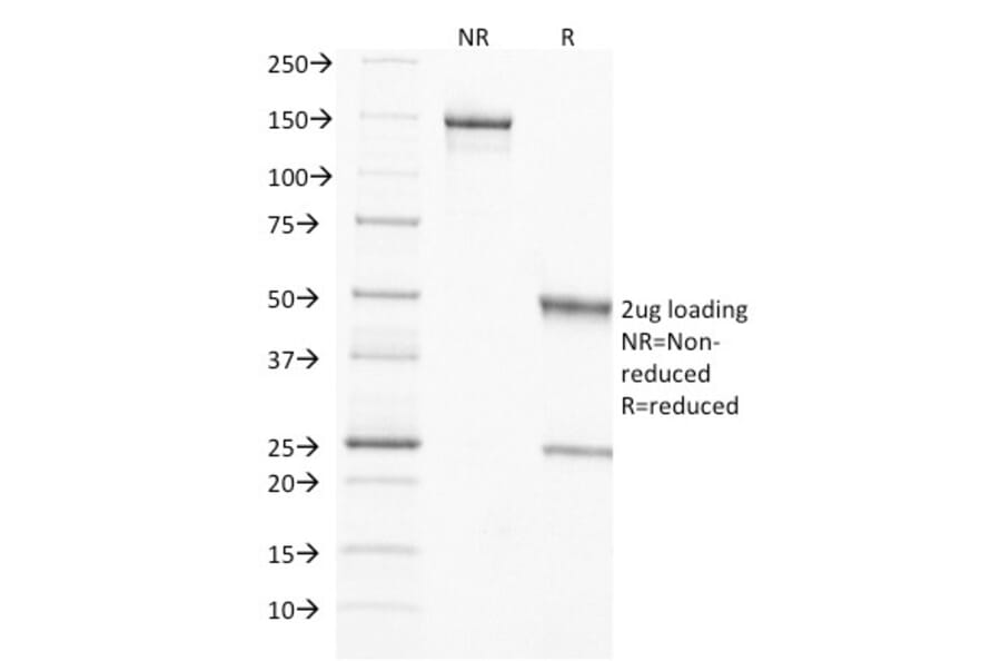 SDS-PAGE - Anti-TIMP2 Antibody [3A4] (A250133) - Antibodies.com