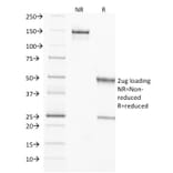 SDS-PAGE - Anti-TIMP2 Antibody [3A4] (A250133) - Antibodies.com