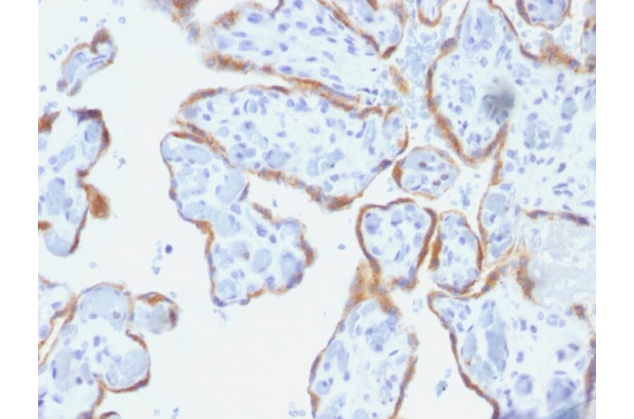Immunohistochemistry - Anti-TIMP2 Antibody [SPM356] (A250133) - Antibodies.com