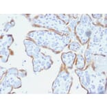 Immunohistochemistry - Anti-TIMP2 Antibody [SPM356] (A250133) - Antibodies.com
