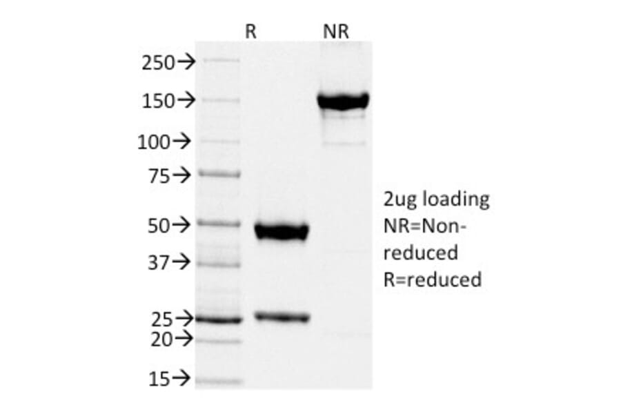 SDS-PAGE - Anti-TIMP2 Antibody [TIMP2/2044] (A250135) - Antibodies.com