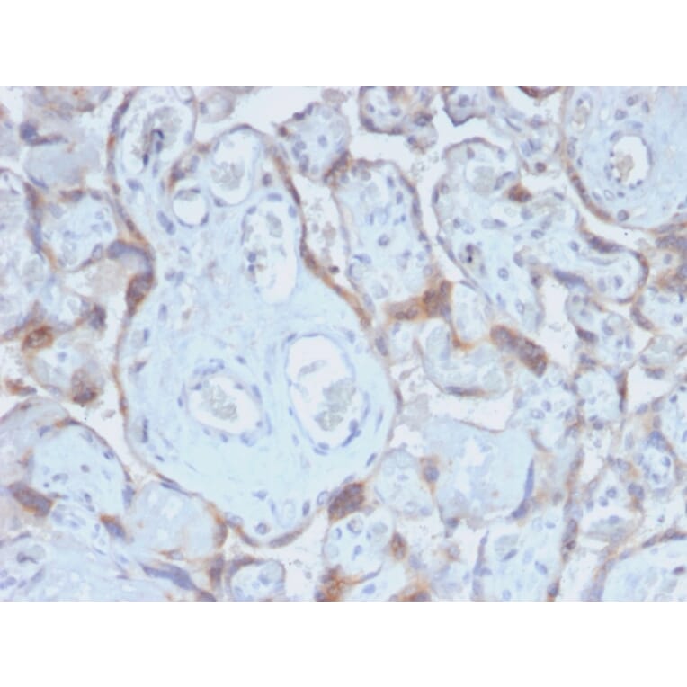 Immunohistochemistry - Anti-TIMP2 Antibody [TIMP2/2488R] (A250136) - Antibodies.com