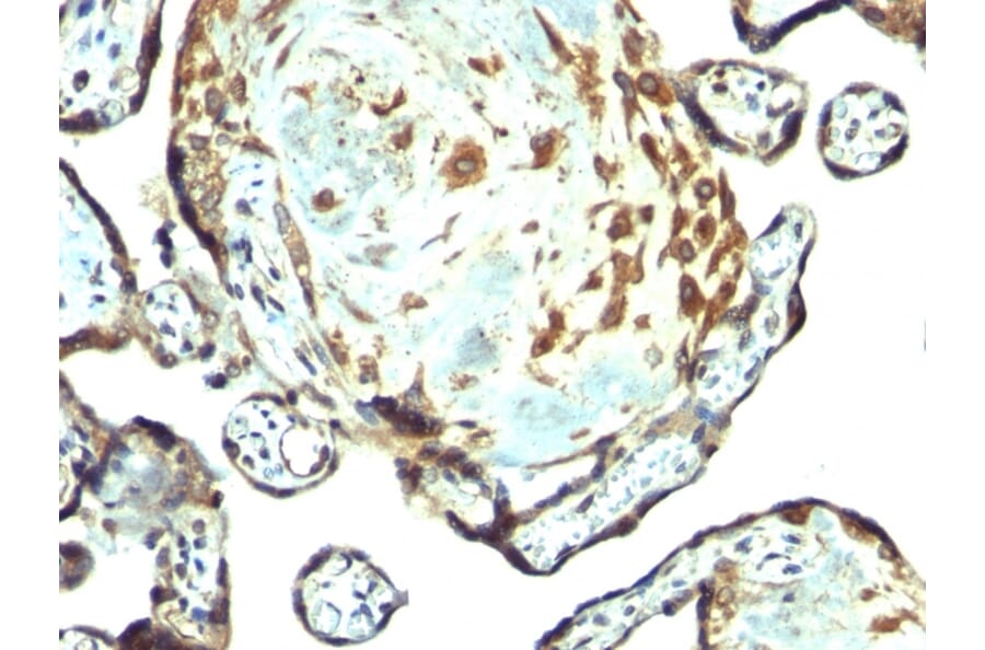 Immunohistochemistry - Anti-TIMP3 Antibody (A250137) - Antibodies.com