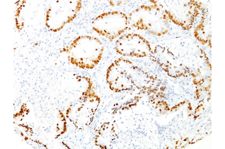 Immunohistochemistry - Anti-TTF1 Antibody [8G7G3/1] (A250138) - Antibodies.com