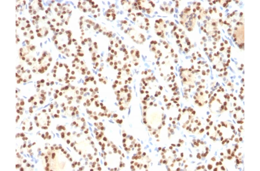 Immunohistochemistry - Anti-TTF1 Antibody [8G7G3/1] (A250139) - Antibodies.com