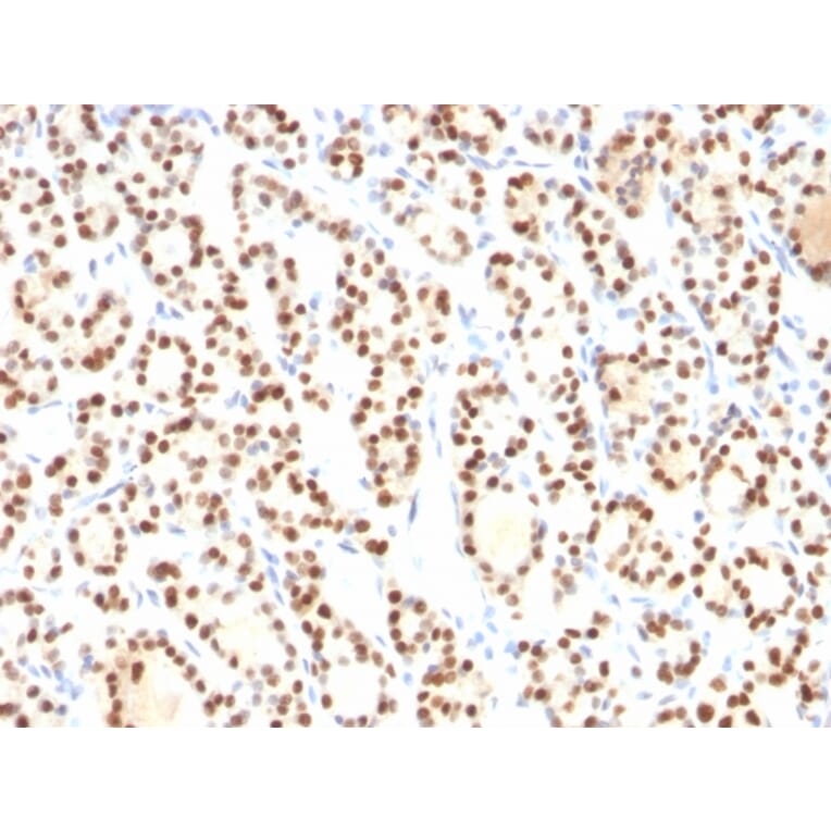 Immunohistochemistry - Anti-TTF1 Antibody [8G7G3/1] (A250139) - Antibodies.com
