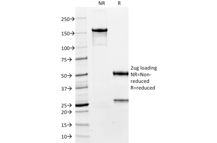 SDS-PAGE - Anti-TTF1 Antibody [8G7G3/1] (A250139) - Antibodies.com