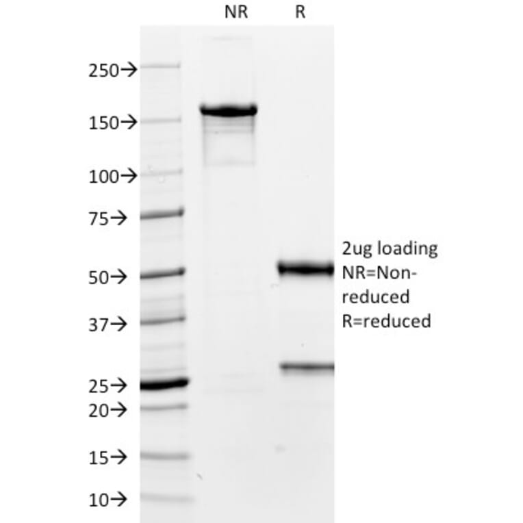 SDS-PAGE - Anti-TTF1 Antibody [8G7G3/1] (A250139) - Antibodies.com