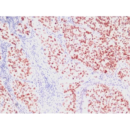 Immunohistochemistry - Anti-TTF1 Antibody [SPM150] (A250139) - Antibodies.com