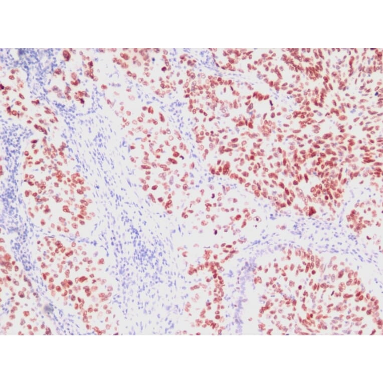 Immunohistochemistry - Anti-TTF1 Antibody [SPM150] (A250139) - Antibodies.com