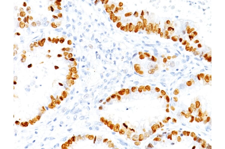 Immunohistochemistry - Anti-TTF1 Antibody [NX2.1/690] (A250140) - Antibodies.com