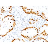 Immunohistochemistry - Anti-TTF1 Antibody [NX2.1/690] (A250140) - Antibodies.com