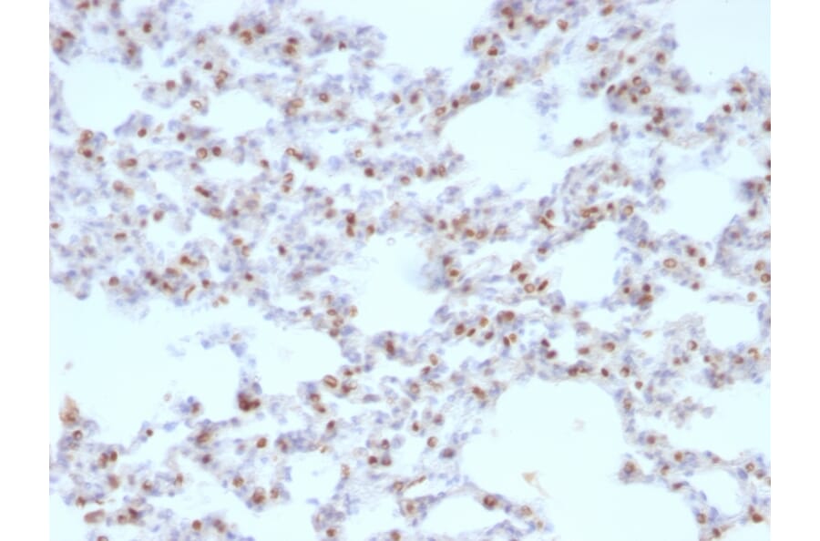 Immunohistochemistry - Anti-TTF1 Antibody [NX2.1/690] (A250141) - Antibodies.com