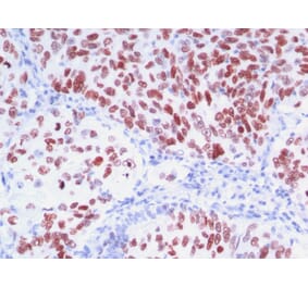 Immunohistochemistry - Anti-TTF1 Antibody [8G7G3/1 + NX2.1/690] (A250141) - Antibodies.com