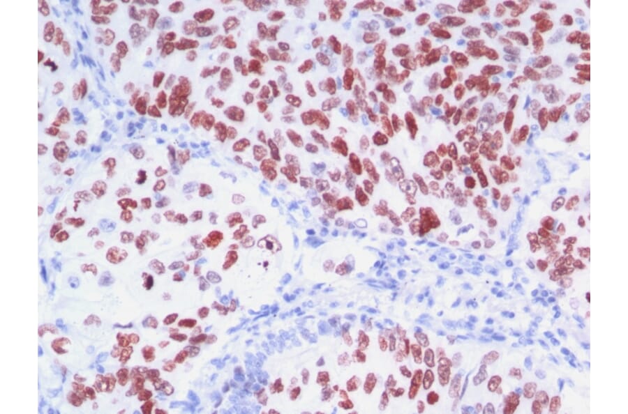Immunohistochemistry - Anti-TTF1 Antibody [8G7G3/1 + NX2.1/690] (A250141) - Antibodies.com