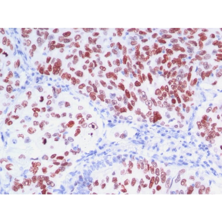 Immunohistochemistry - Anti-TTF1 Antibody [8G7G3/1 + NX2.1/690] (A250141) - Antibodies.com
