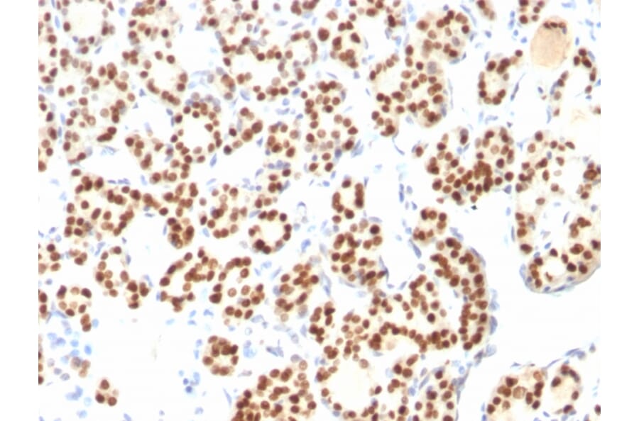 Immunohistochemistry - Anti-TTF1 Antibody [8G7G3/1 + NX2.1/690] (A250142) - Antibodies.com